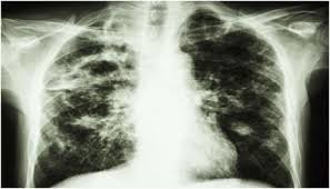 آخرین وضعیت \