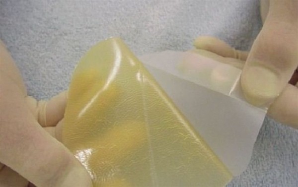 پژوهشگران دانشگاه صنعتی امیرکبیر موفق به تولید پانسمانهای پلیمری شدند