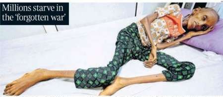 تایمز: میلیون‌ها یمنی با گرسنگی کشنده دست‌وپنجه نرم می‌کنند