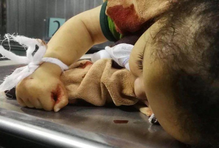 24 فلسطینی در بمباران هوایی در غزه کشته شدند